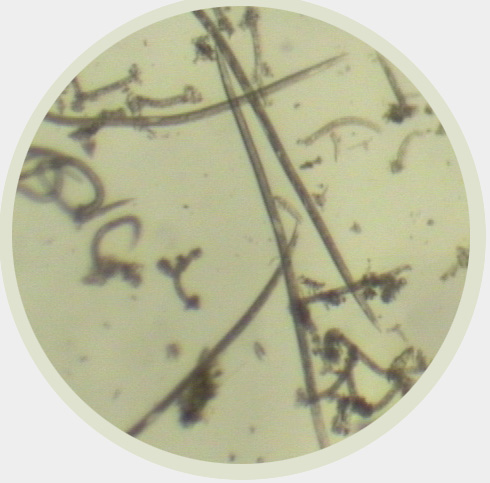 Anguina tritici- regulated nematode